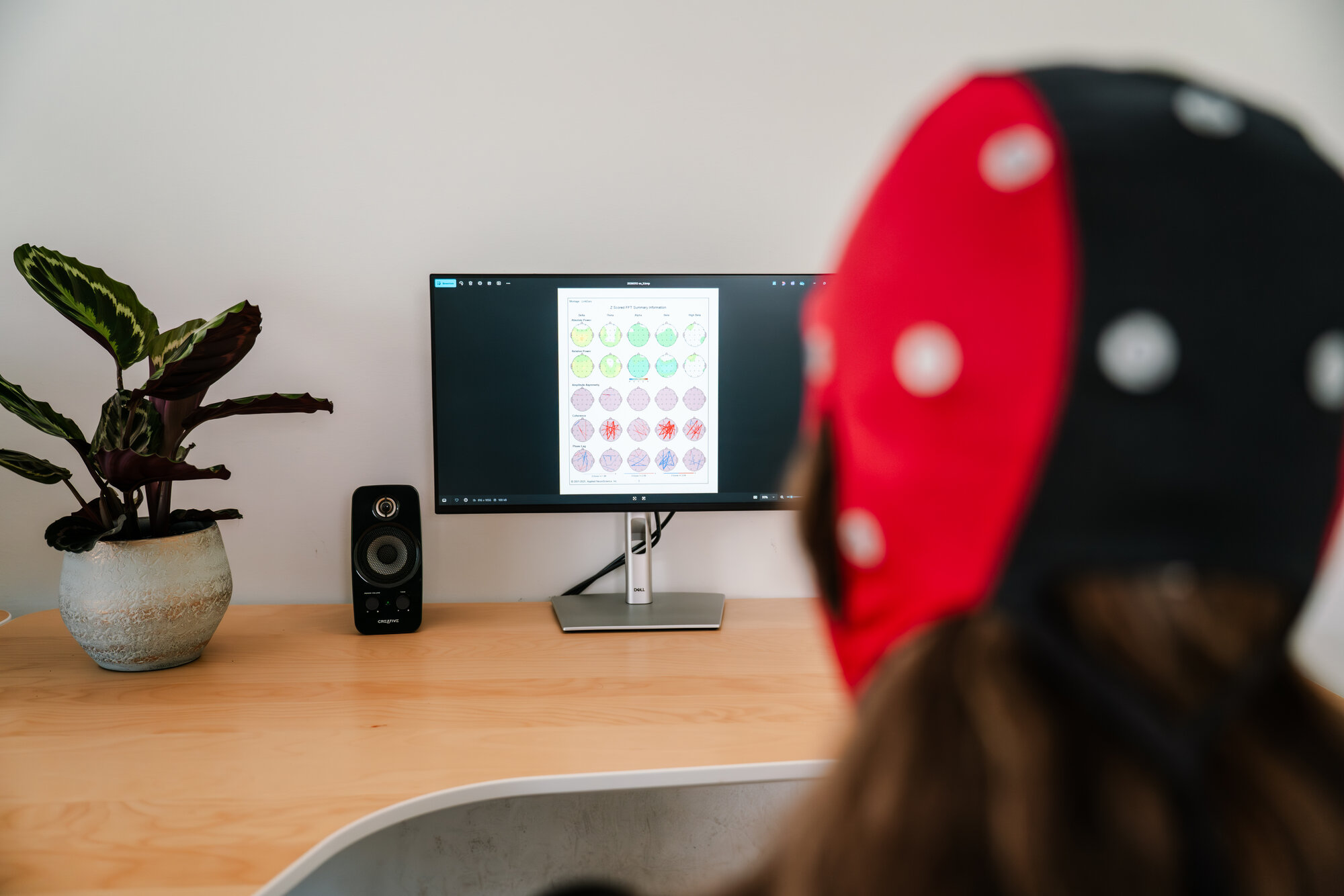 Neurofeedback QEEG meting