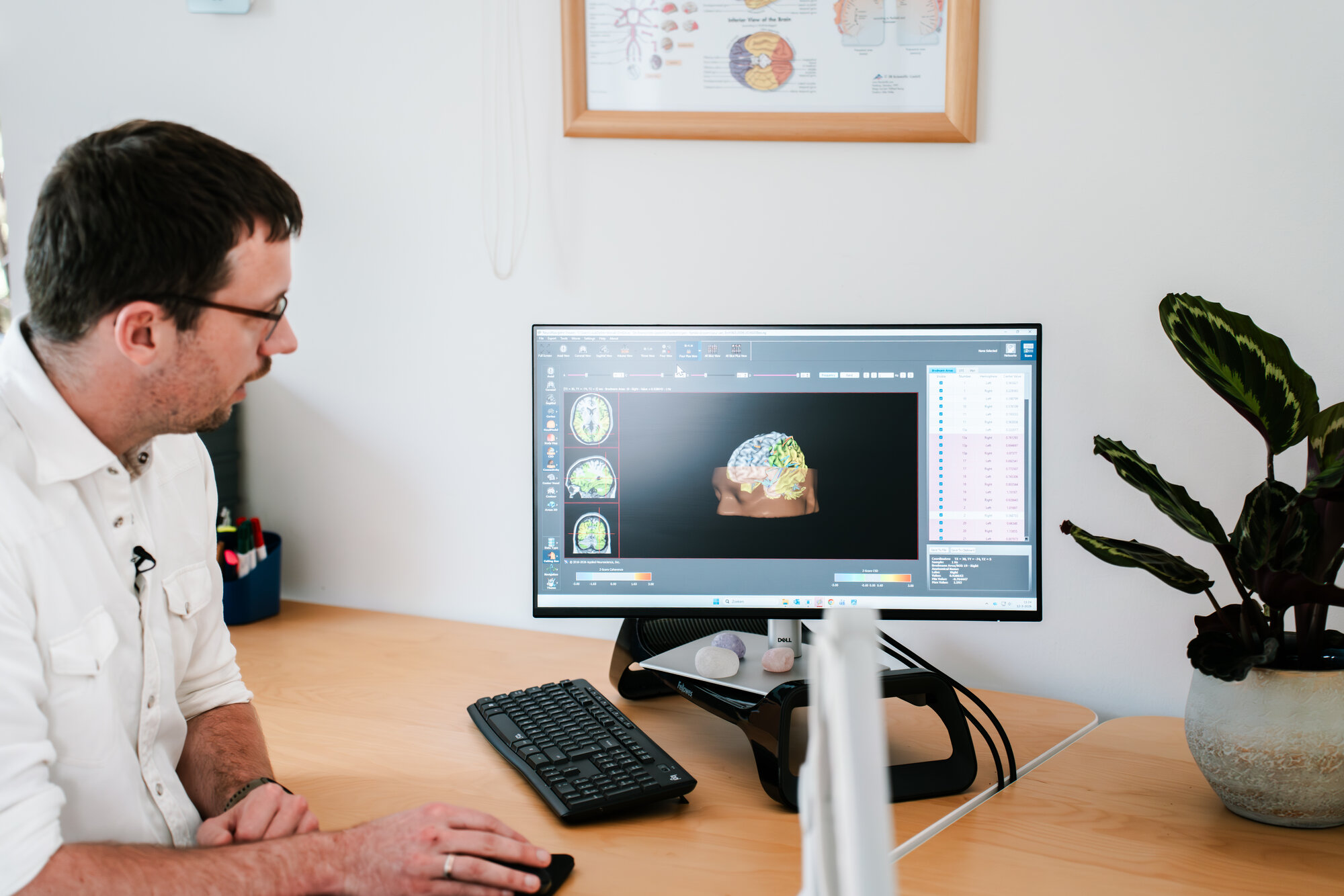 swLORETA Z Score neurofeedback